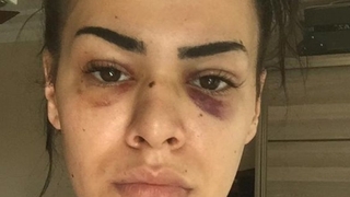 Nagehan dehşeti yaşadı