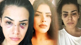 Nagehan koruma talebinde bulunacak