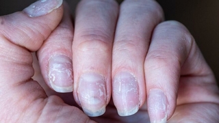 Omicron'un yeni belirtisi ortaya çıktı