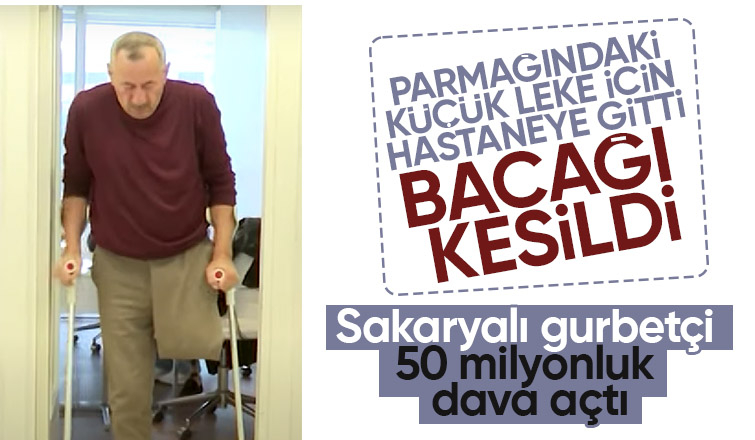 Parmağında küçük leke çıktı, bacağı kesildi