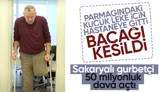 Parmağında küçük leke çıktı, bacağı kesildi