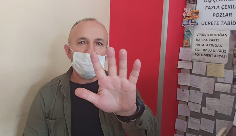 Parmaklarını yapıştırdı