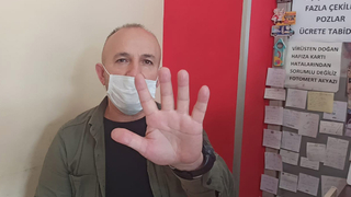 Parmaklarını yapıştırdı