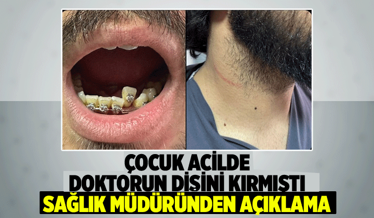 Sağlık Müdürü'nden doktora saldırı açıklaması