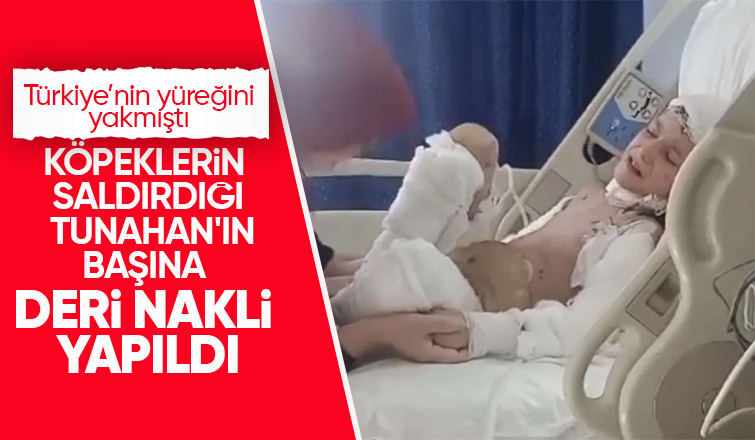 Sahipsiz köpeklerin saldırmıştı Tunahan 15. ameliyatını oldu