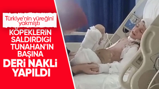 Sahipsiz köpeklerin saldırmıştı Tunahan 15. ameliyatını oldu
