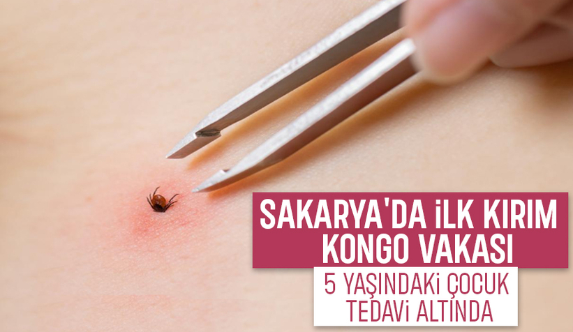 Sakarya'da ilk kırım kongo vakası