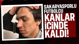 Sakaryasporlu futbolcu gol attı, kanlar içinde kaldı