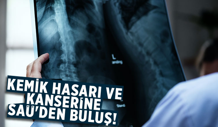 SAÜ'de kemik hasarlarında kullanılacak malzeme geliştirildi