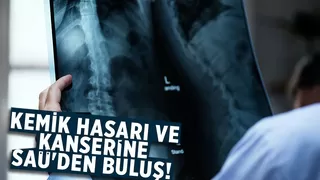 SAÜ'de kemik hasarlarında kullanılacak malzeme geliştirildi