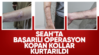 SEAH’ta iki başarılı ameliyatla kopan uzuvlar kurtarıldı