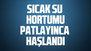 Sıcak su hortumu patlayınca haşlandı