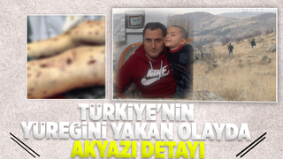 Sokak köpekleri ağır yaralamıştı Tunahan Akyazıdan Ankaraya gitmiş