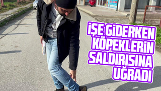 Sokak köpeklerinin saldırısına uğradı