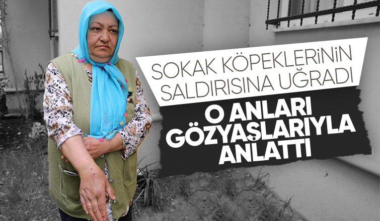 Sokak köpeklerinin saldırısına uğradı
