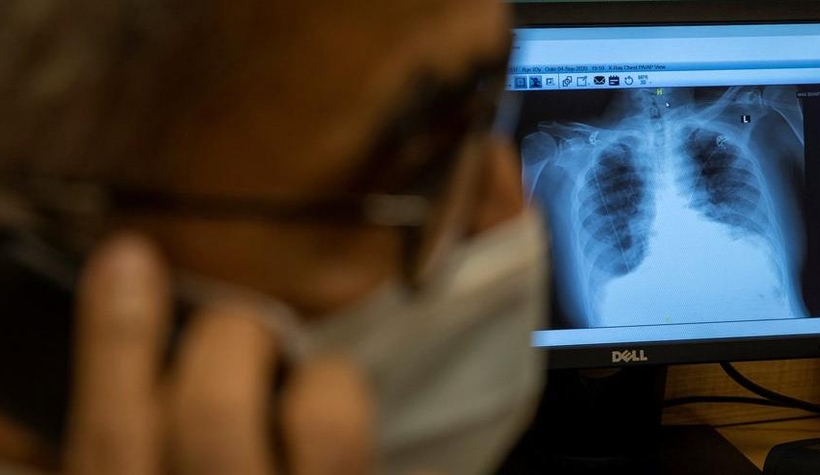 Taburcu olduktan 3 ay sonra şaşkına çeviren sonuç