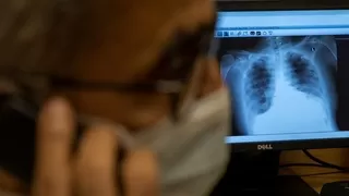 Taburcu olduktan 3 ay sonra şaşkına çeviren sonuç