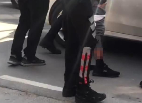 Ters yöne giren polis sürücüyü bacağından vurdu