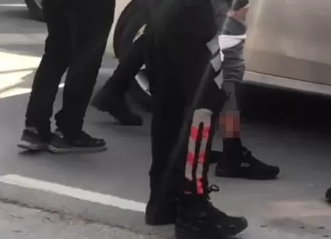 Ters yöne giren polis sürücüyü bacağından vurdu