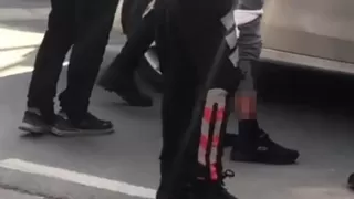 Ters yöne giren polis sürücüyü bacağından vurdu