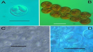 Türk bilim insanları, 4 yeni parazit türü keşfetti