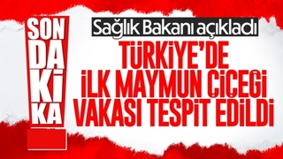 Türkiye'de ilk maymun çiçeği vakası tespit edildi