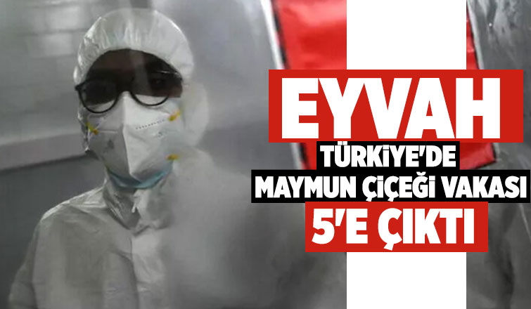 Türkiye’de maymun çiçeği vakaları yükseldi