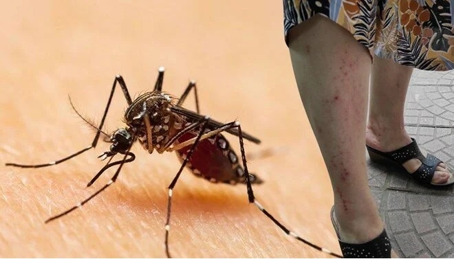 Uzman isim vatandaşları uyardı: Ölümcül olabilir