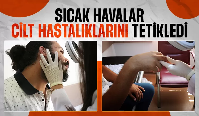 Uzmanı uyardı: Deride oluşan sıyrık, çizik ve çatlaklara dikkat