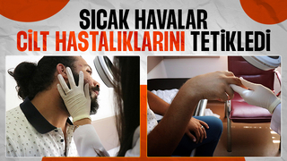 Uzmanı uyardı: Deride oluşan sıyrık, çizik ve çatlaklara dikkat