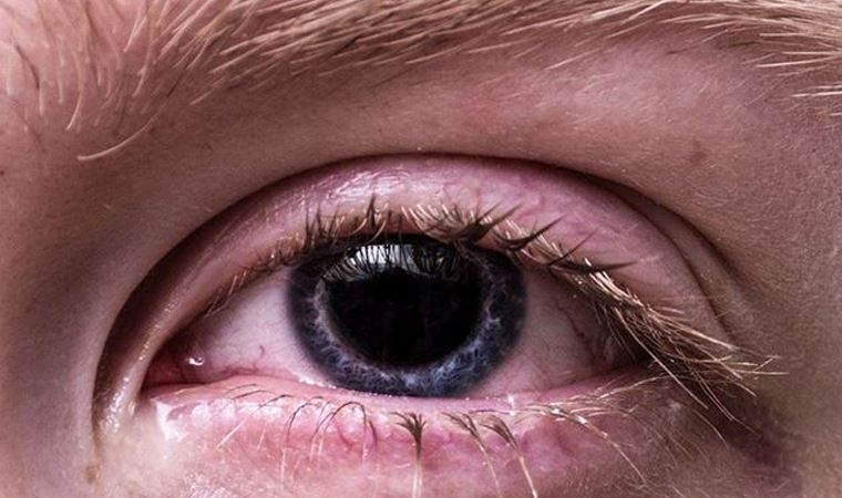 Uzmanı uyardı; Korona belirtisi olabilir