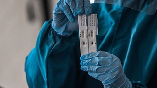 Virüse karşı bağışıklığı ölçen yeni test