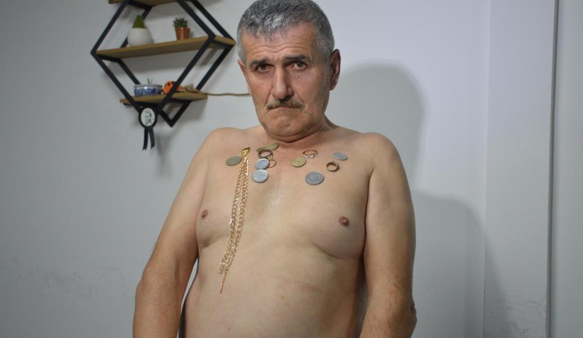 Vücuduna koyduğu materyalleri mıknatıs gibi çekiyor