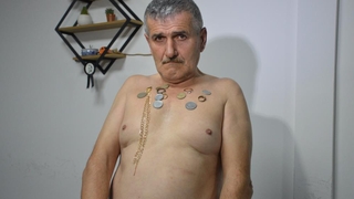 Vücuduna koyduğu materyalleri mıknatıs gibi çekiyor