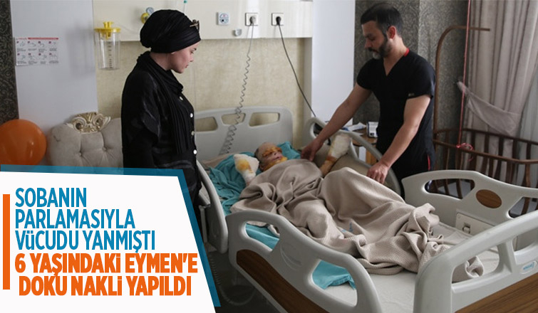 Vücudunun yüzde 65'i yanan Eymen'e doku nakli