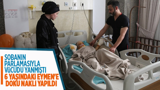 Vücudunun yüzde 65'i yanan Eymen'e doku nakli