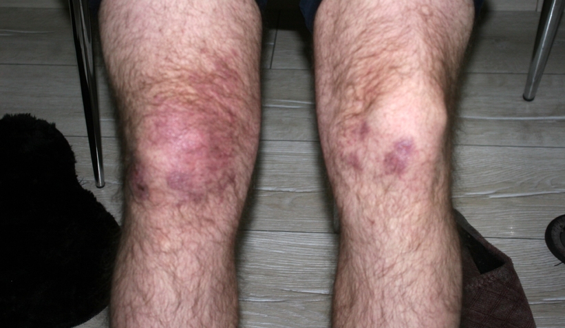  Yaş betona dokununca olanlar oldu