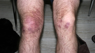  Yaş betona dokununca olanlar oldu