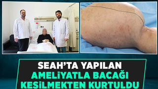 Bacağında devasa boyutta tümör oluştu