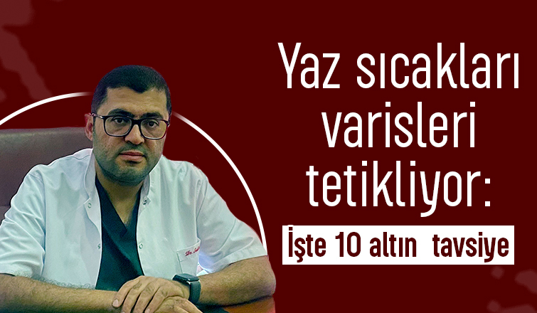 Yaz sıcakları varisleri tetikliyor