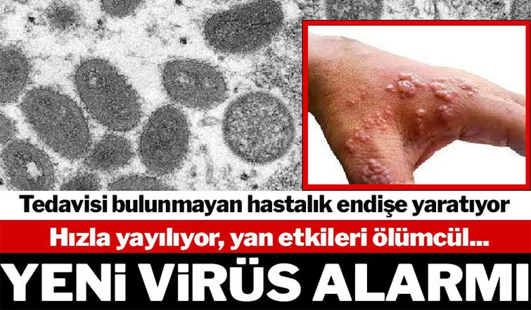 Yeni Virüs alarmı
