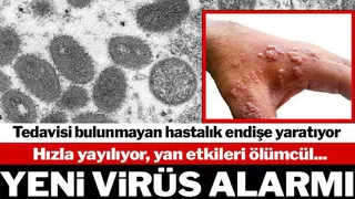 Yeni Virüs alarmı