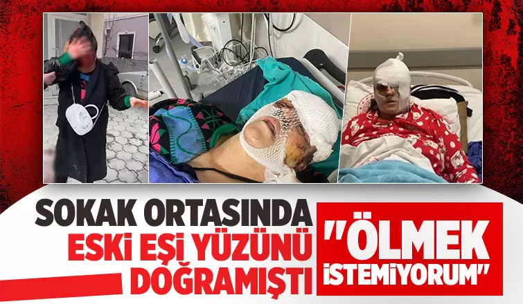 Yüzü paramparça olan kadın tek gözünü kaybedebilir