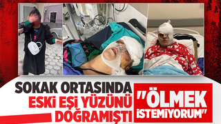 Yüzü paramparça olan kadın tek gözünü kaybedebilir